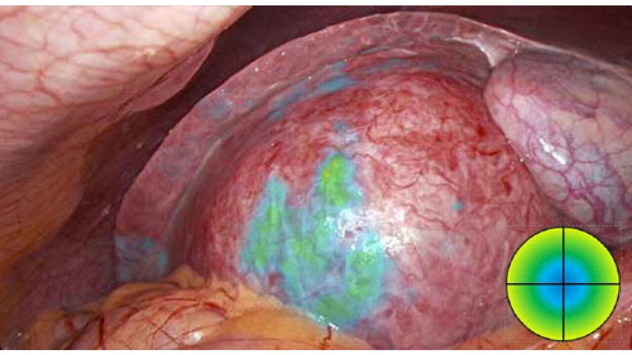 mode fluorescence ISO VEQTRON® ICG/NIR