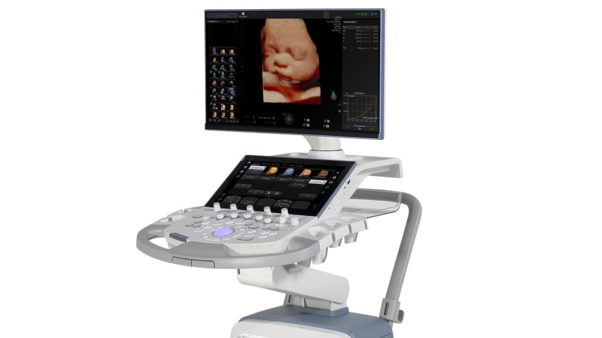 Un appareil d'échographie médicale affiche sur son écran une image 3D détaillée d'un fœtus. L'appareil est doté d'un panneau de commande avec de nombreux boutons et d'un moniteur monté au-dessus.