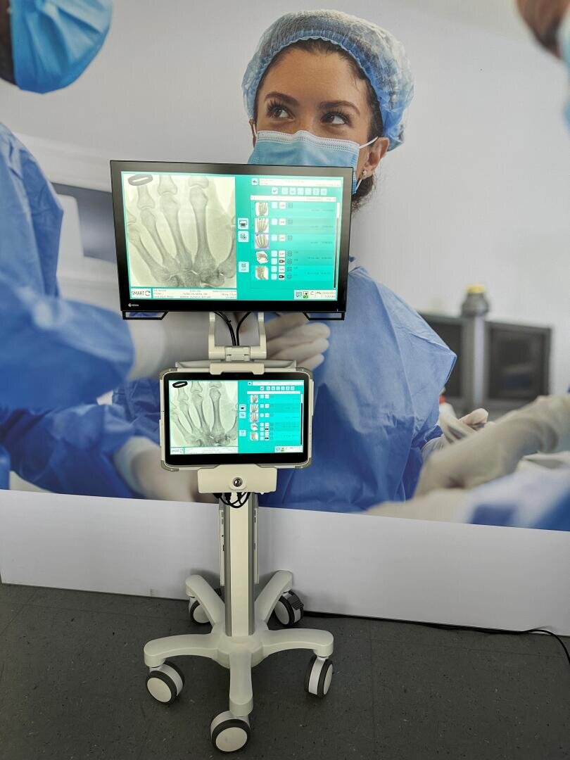 Ein medizinischer Arbeitsplatz mit zwei Bildschirmen, auf denen ein Röntgenbild der Füße und Daten angezeigt werden, steht auf Rädern vor einer Wand, die eine medizinische Fachkraft in Kittel und Haarnetz zeigt.