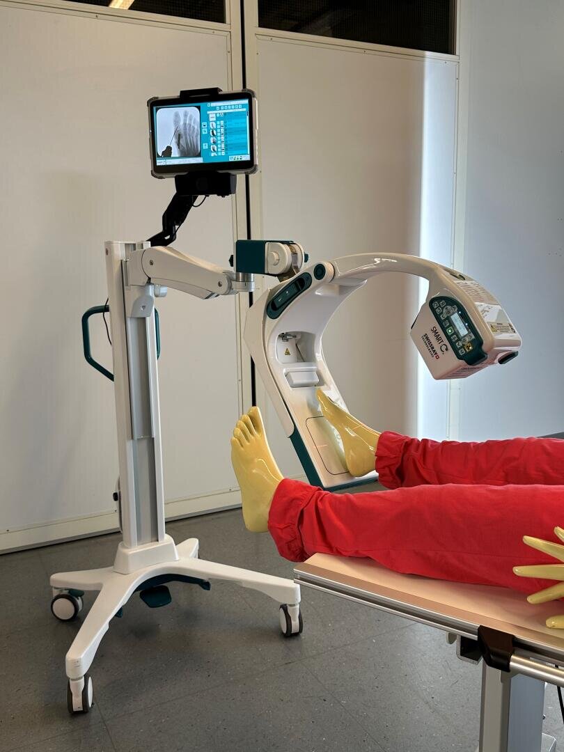 Ein medizinisches Bildgebungsgerät scannt die Füße eines Patienten, der eine rote Hose und gelbe Schuhüberzieher trägt. Ein montierter Bildschirm zeigt Röntgenbilder über den Unterschenkeln des Patienten an. Die Szene befindet sich in einer klinischen Umgebung.