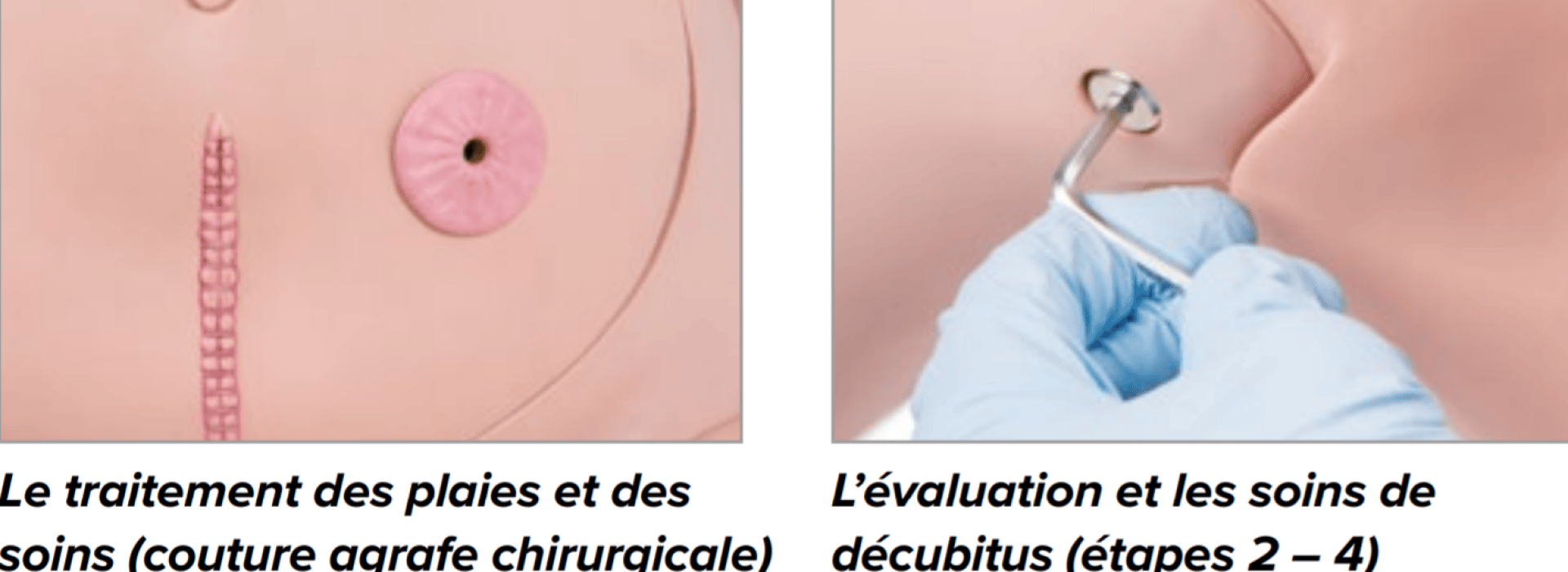 Zwei Nahaufnahmen eines medizinischen Übungspuppens: Die eine zeigt einen chirurgischen Schnitt und ein Stoma, die andere eine behandschuhte Hand, die eine Sonde in ein Dekubitusgeschwür einführt.