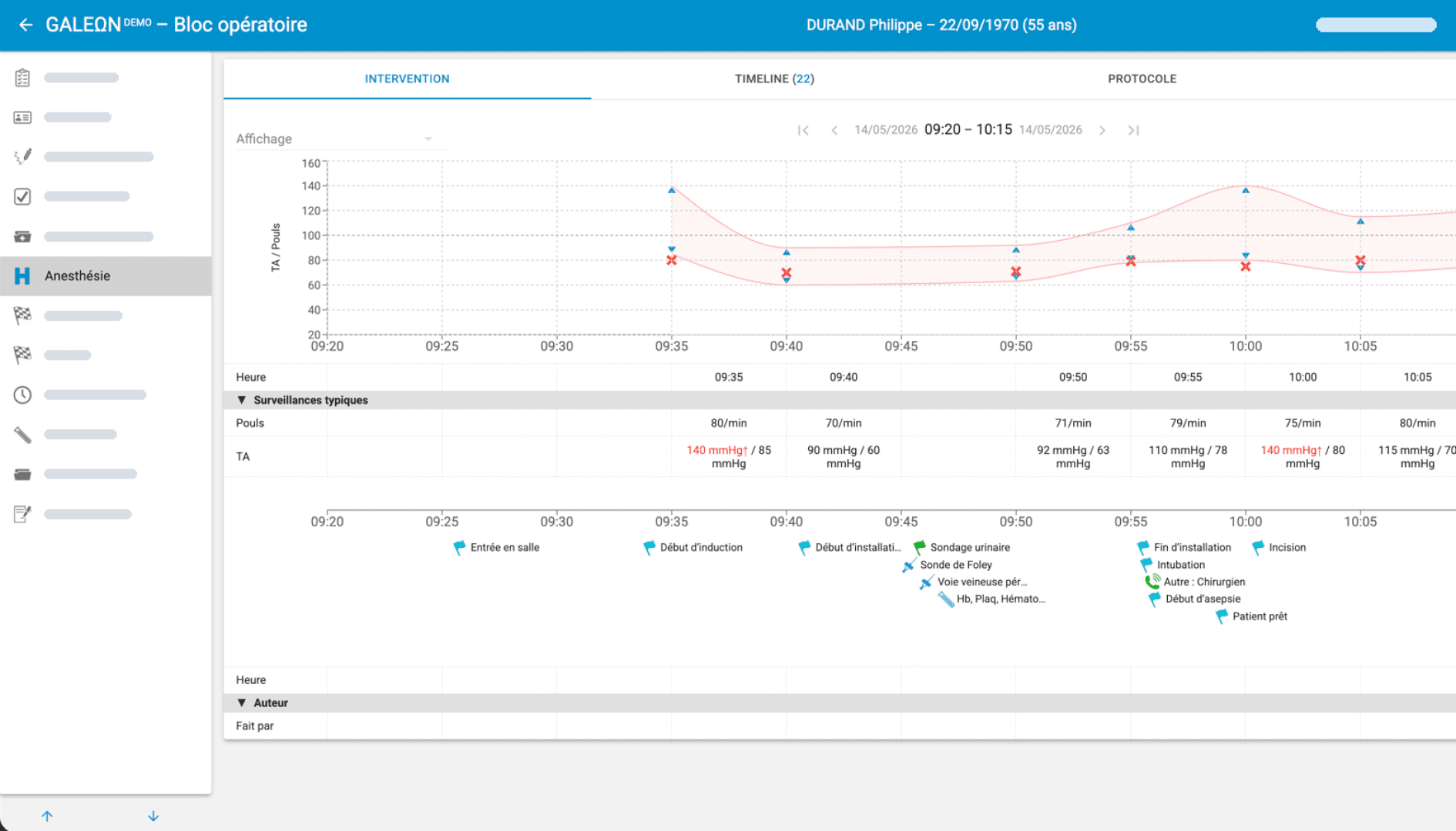 Medizinisches Dashboard, das den Verlauf der Anästhesie eines Patienten darstellt, einschließlich einer Grafik der Vitalparameter, der Zeitangaben zu den Eingriffen und eines Aktivitätsprotokolls mit Symbolen, die verschiedenen Maßnahmen wie dem Anlegen einer Infusion, der Überwachung und der Verabreichung von Medikamenten entsprechen.