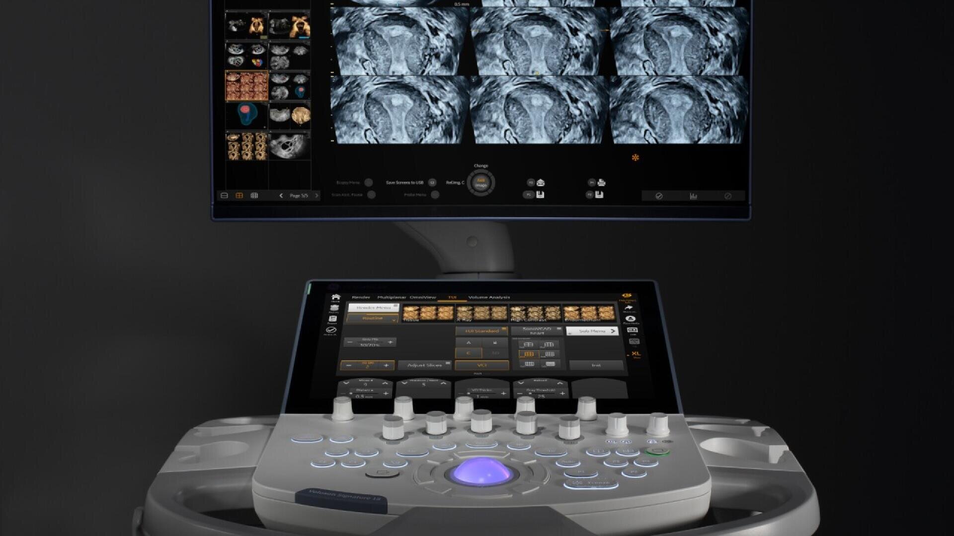 Un poste de travail d'imagerie médicale affiche des images d'IRM sur un moniteur supérieur, tandis qu'un écran tactile inférieur affiche des options de contrôle et divers boutons et cadrans pour faire fonctionner l'appareil.