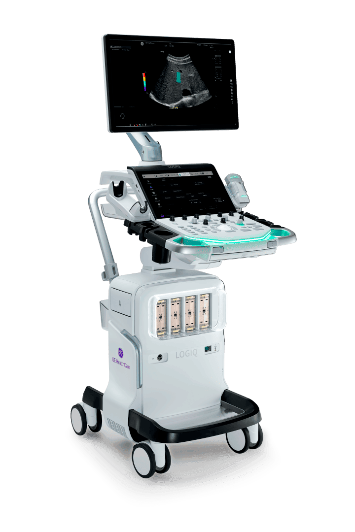 Appareil d'échographie médicale moderne doté d'un grand écran affichant une image d'échographie, d'un panneau de commande avec des boutons et des molettes, et de roues pour la mobilité.