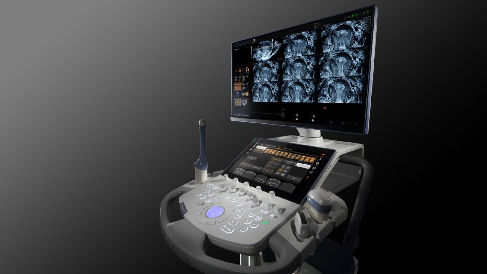 Un appareil d'échographie moderne avec un panneau de commande, une sonde et un écran d'affichage montrant plusieurs images médicales en noir et blanc. L'appareil est placé sur un fond dégradé sombre.
