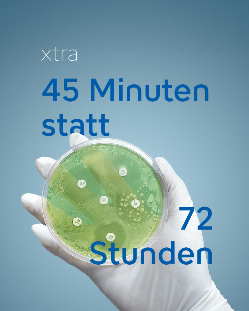Eine Hand in einem Handschuh hält eine Petrischale mit einer grünen Agarkultur, über der der Text xtra 45 Minuten statt 72 Stunden zu sehen ist.