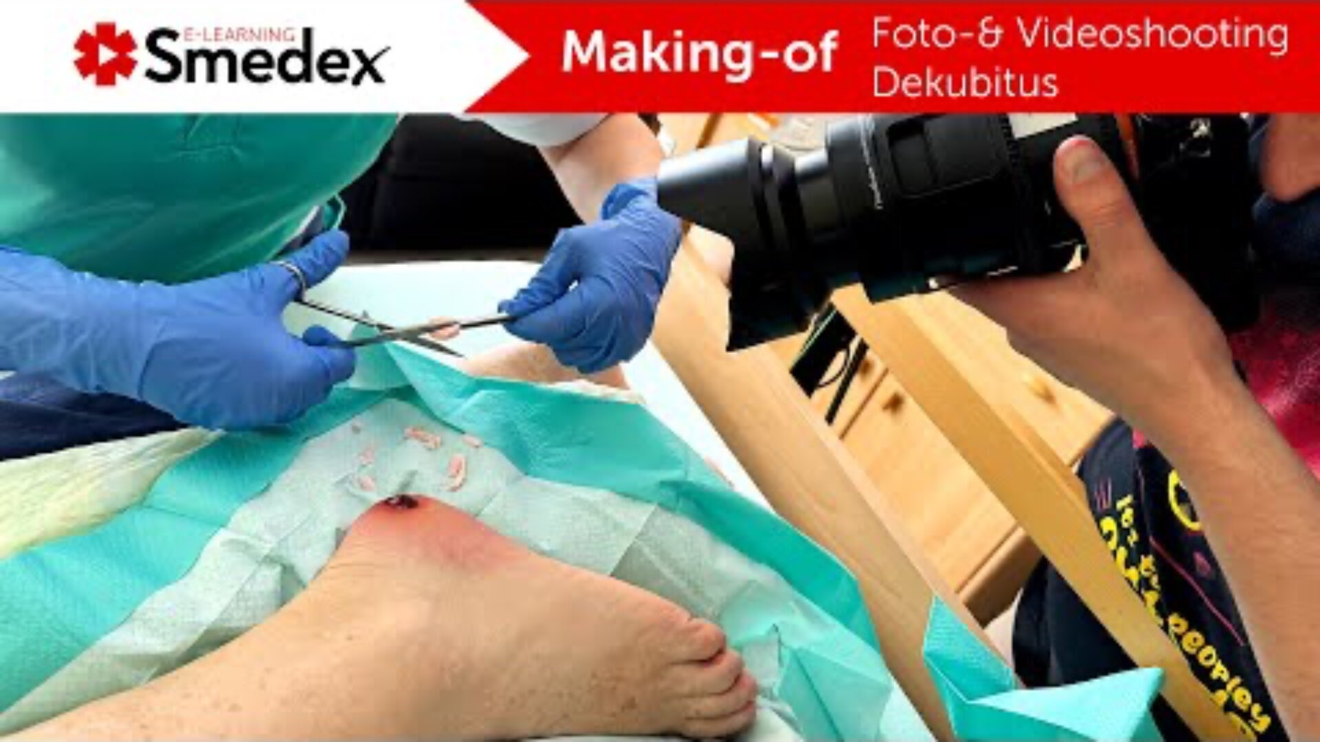Eine Person, die Handschuhe trägt, versorgt eine Wunde am Fuß eines Patienten, während eine andere Person mit einer Kamera Nahaufnahmen macht. Das Bild ist mit einem roten Banner versehen, auf dem Smedex E-Learning steht: Making-of Foto- & Videoaufnahmen Dekubitus.