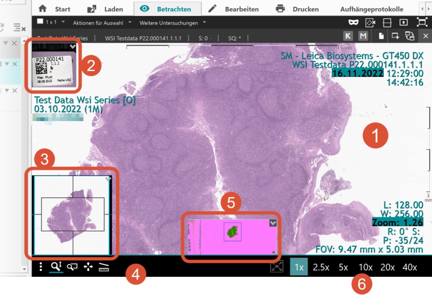 Der Patho-Viewer ist in folgende Bereiche gegliedert:  (1) Hauptansicht mit Gewebeprobe, (2) - QR-Code (falls vorhanden): enthält Informationen der Patientin, des Patienten. (3) Übersichtsfenster, (4) Werkzeugleiste, (5) Makroskopisches Bild (falls vorhanden): zeigt den ganzen Scan der Gewebeprobe mit ggf. Einfärbung an. (6) Zoomstufen